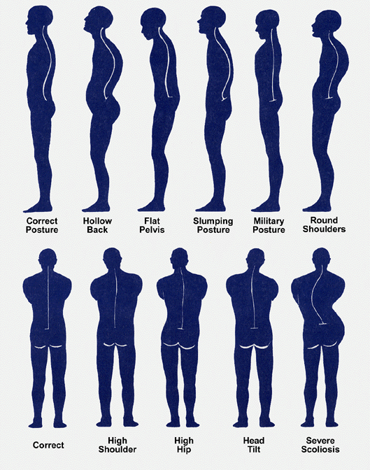 posture chart